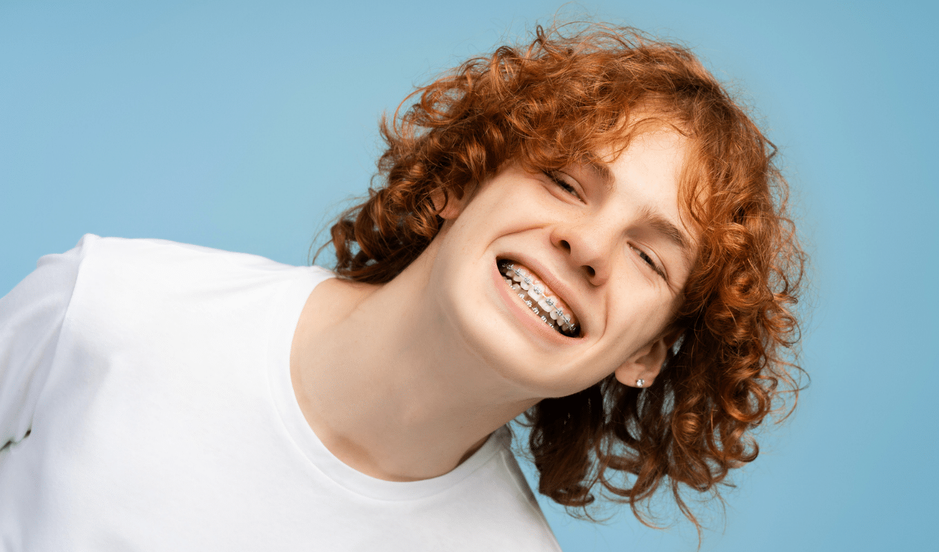Close-up smile with metal braces types of braces page | Advanced Orthodontics in Burien, WA